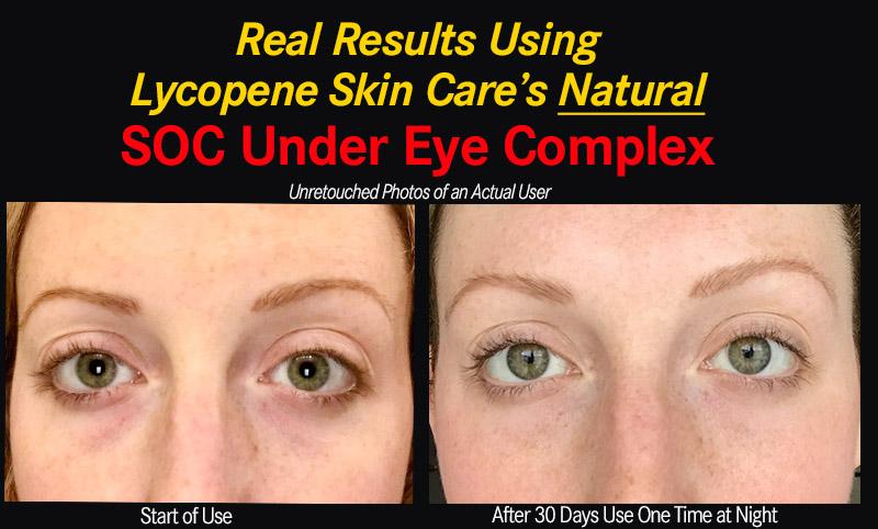 The Two Products The Eye & Lip System - Everything You Need in Two Products - Save 20%